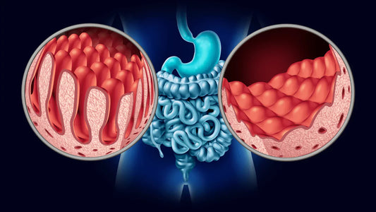 Can BCP help with Crohn’s Disease and IBS?